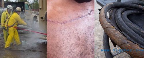 �߉���ϴ�C�����Б�ע��İ�ȫ���}